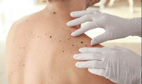 5 признака, че лекар спешно трябва да види бенките ви 6 https://netnews.bg/wp-content/uploads/2021/08/5-d0bfd180d0b8d0b7d0bdd0b0d0bad0b0-d187d0b5-d0bbd0b5d0bad0b0d180-d181d0bfd0b5d188d0bdd0be-d182d180d18fd0b1d0b2d0b0-d0b4d0b0-d0b2d0b8.jpg 5 d0bfd180d0b8d0b7d0bdd0b0d0bad0b0 d187d0b5 d0bbd0b5d0bad0b0d180 d181d0bfd0b5d188d0bdd0be d182d180d18fd0b1d0b2d0b0 d0b4d0b0 d0b2d0b8 https://netnews.bg/wp-content/uploads/2021/08/5-d0bfd180d0b8d0b7d0bdd0b0d0bad0b0-d187d0b5-d0bbd0b5d0bad0b0d180-d181d0bfd0b5d188d0bdd0be-d182d180d18fd0b1d0b2d0b0-d0b4d0b0-d0b2d0b8.jpg