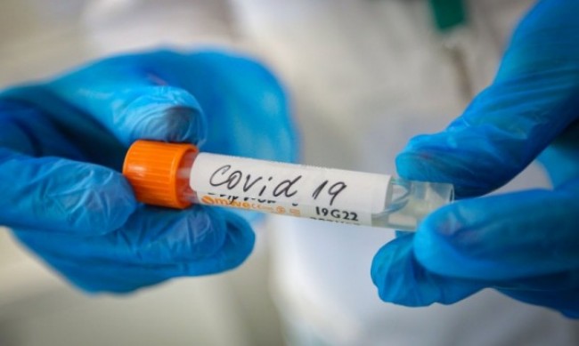 8012 са новите случаи на COVID-19, 176 души са починали 5 https://netnews.bg/wp-content/uploads/2022/02/8012-d181d0b0-d0bdd0bed0b2d0b8d182d0b5-d181d0bbd183d187d0b0d0b8-d0bdd0b0-covid-19-176-d0b4d183d188d0b8-d181d0b0-d0bfd0bed187d0b8d0bdd0b0d0bb.jpg 8012 d181d0b0 d0bdd0bed0b2d0b8d182d0b5 d181d0bbd183d187d0b0d0b8 d0bdd0b0 covid 19 176 d0b4d183d188d0b8 d181d0b0 d0bfd0bed187d0b8d0bdd0b0d0bb https://netnews.bg/wp-content/uploads/2022/02/8012-d181d0b0-d0bdd0bed0b2d0b8d182d0b5-d181d0bbd183d187d0b0d0b8-d0bdd0b0-covid-19-176-d0b4d183d188d0b8-d181d0b0-d0bfd0bed187d0b8d0bdd0b0d0bb.jpg